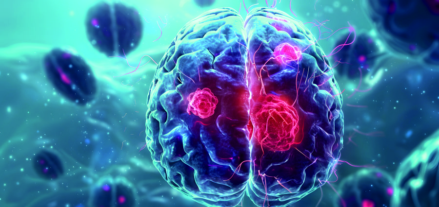 New Blood Test Offers Hope for Early Glioblastoma Diagnosis